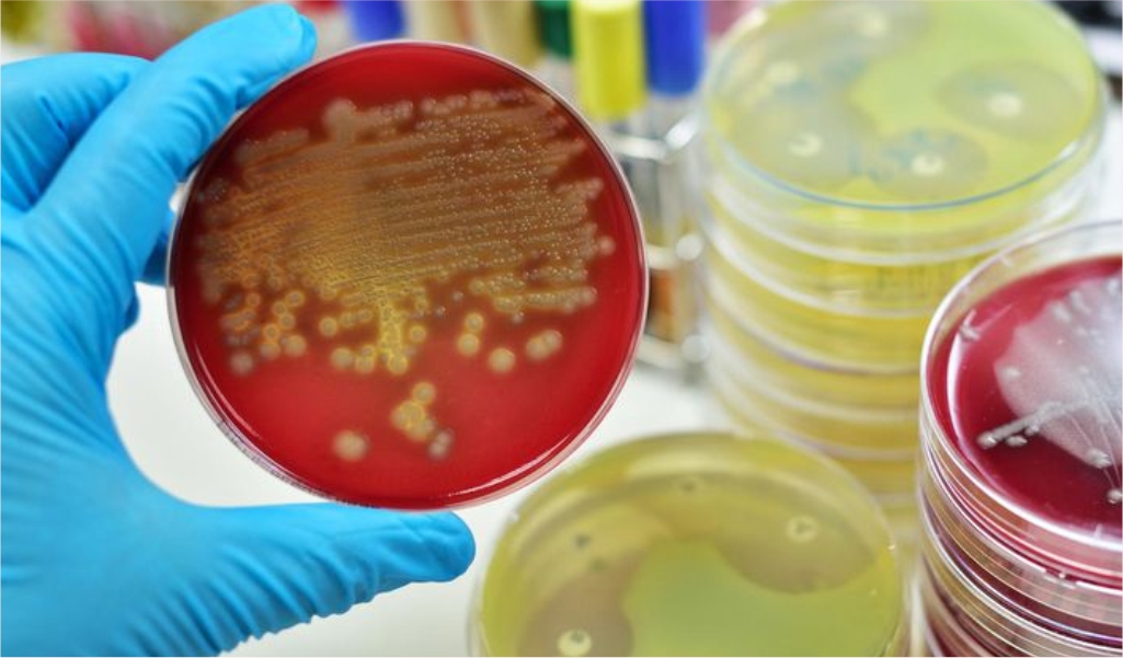 Почему тампоны могут привести к СТШ