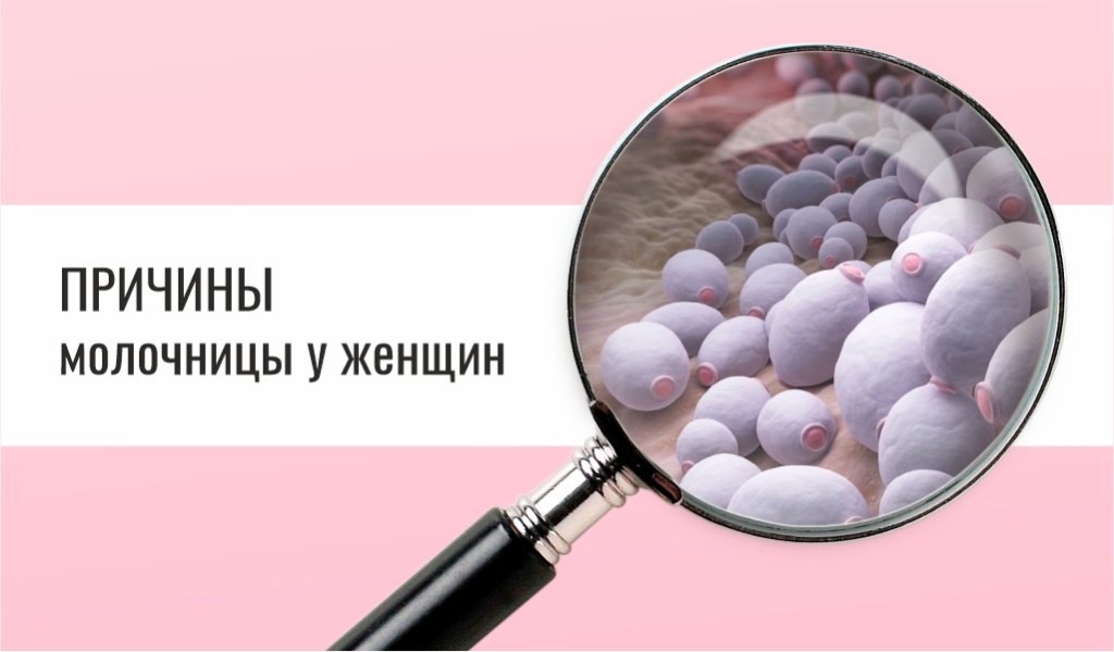 Как избавиться от молочницы?